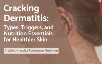 Cracking Dermatitis: Types, triggers, and nutrition essentials for healthier skin