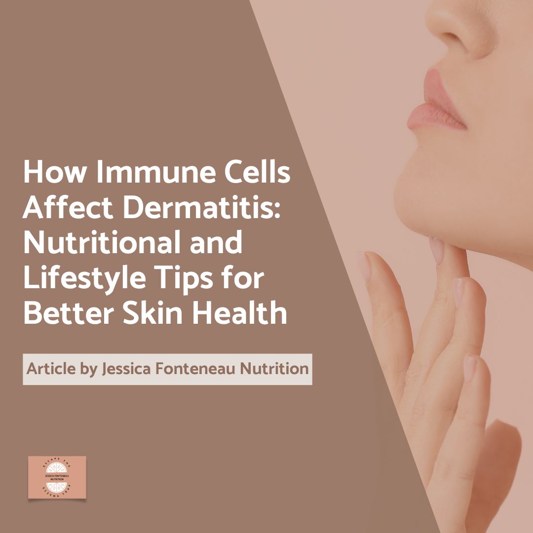 How Immune Cells Affect Dermatitis Nutritional and Lifestyle Tips for Better Skin Health