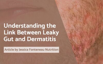 Understanding the Link Between Leaky Gut and Dermatitis
