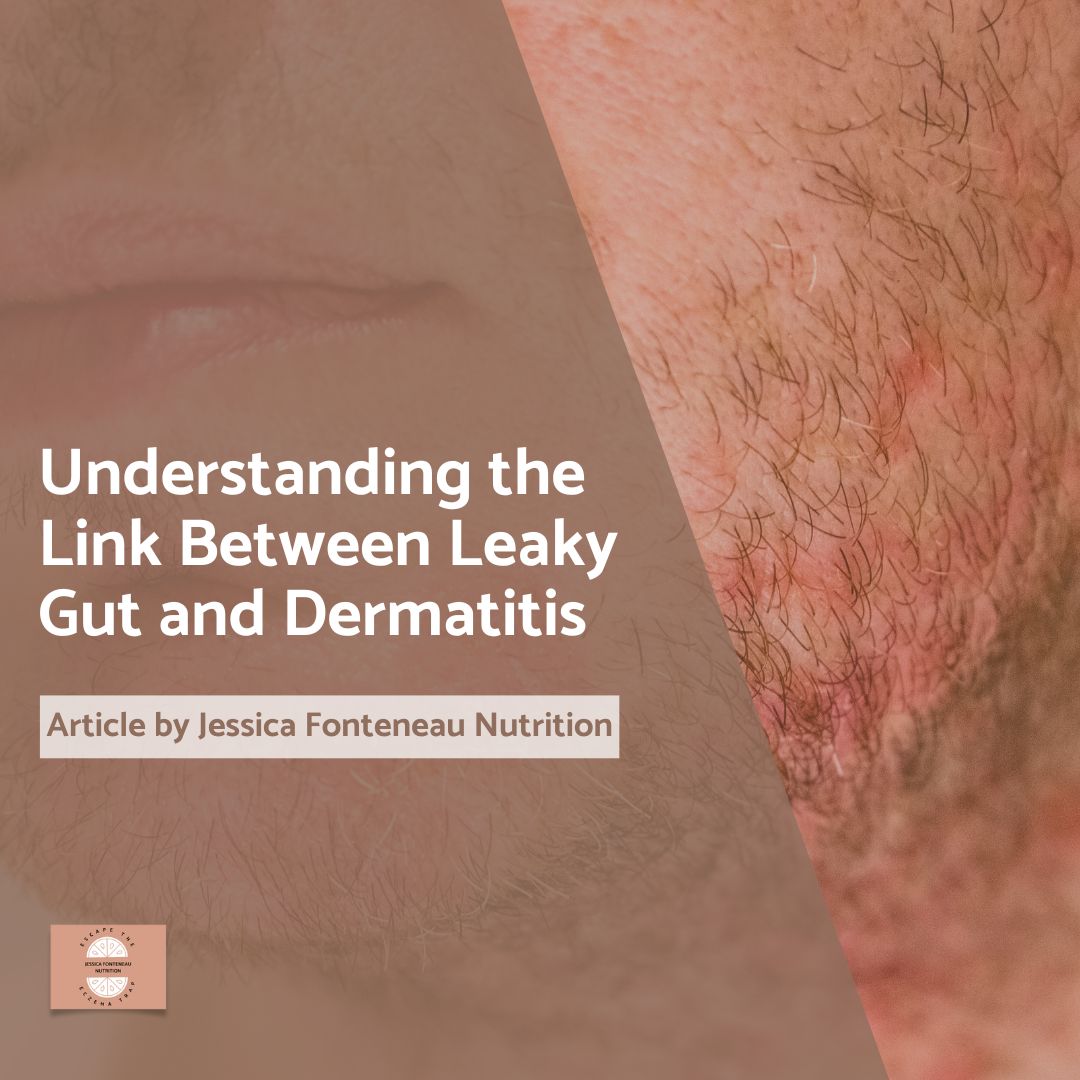 Understanding the Link Between Leaky Gut and Dermatitis Understanding the Link Between Leaky Gut and Dermatitis
