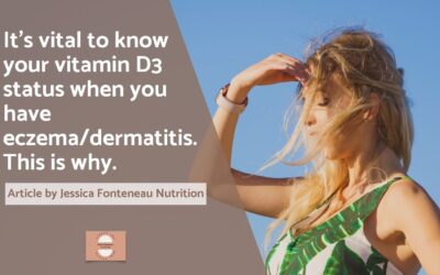It’s vital to know your vitamin D3 status when you have eczema/dermatitis. This is why.