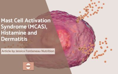 Mast Cell Activation Syndrome (MCAS), Histamine and Dermatitis