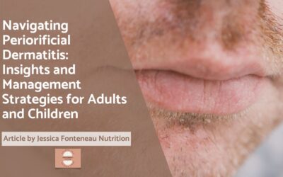 Navigating Periorificial Dermatitis: Insights and Management Strategies for Adults and Children
