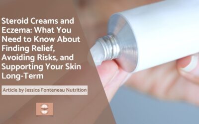 Steroid Creams and Eczema: What You Need to Know About Finding Relief, Avoiding Risks, and Supporting Your Skin Long-Term