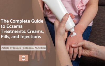 The Complete Guide to Eczema Treatments: Creams, Pills, and Injections