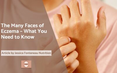 The Many Faces of Eczema – What You Need to Know