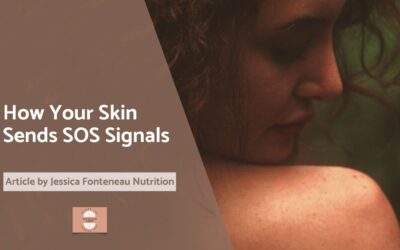 Eczema Flare Triggers: How Your Skin Sends SOS Signals