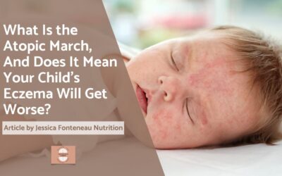 What Is the Atopic March, And Does It Mean Your Child’s Eczema Will Get Worse?