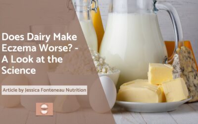 Does Dairy Make Eczema Worse? A Look at the Science