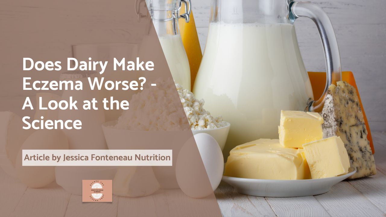 Does Dairy Make Eczema Worse? A Look at the Science