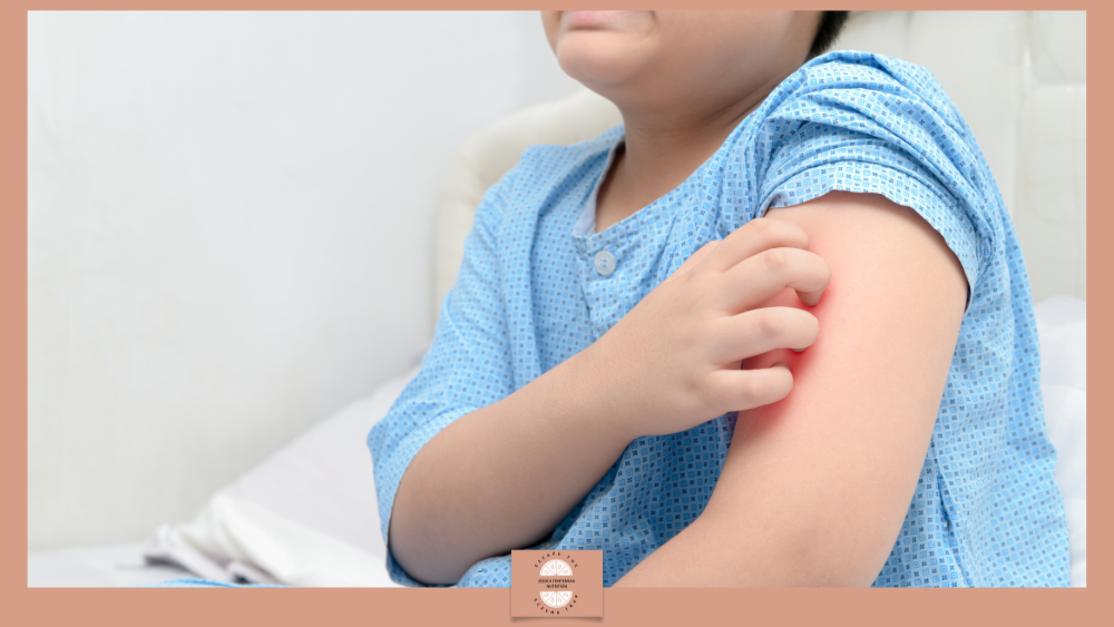 Eczema and hot weather - Jessica Fonteneau Nutrition Eczema and hot weather - child with itchy arm
