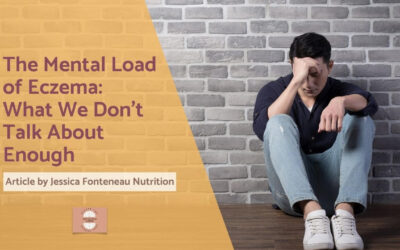 The Mental Load of Eczema: What We Don’t Talk About Enough