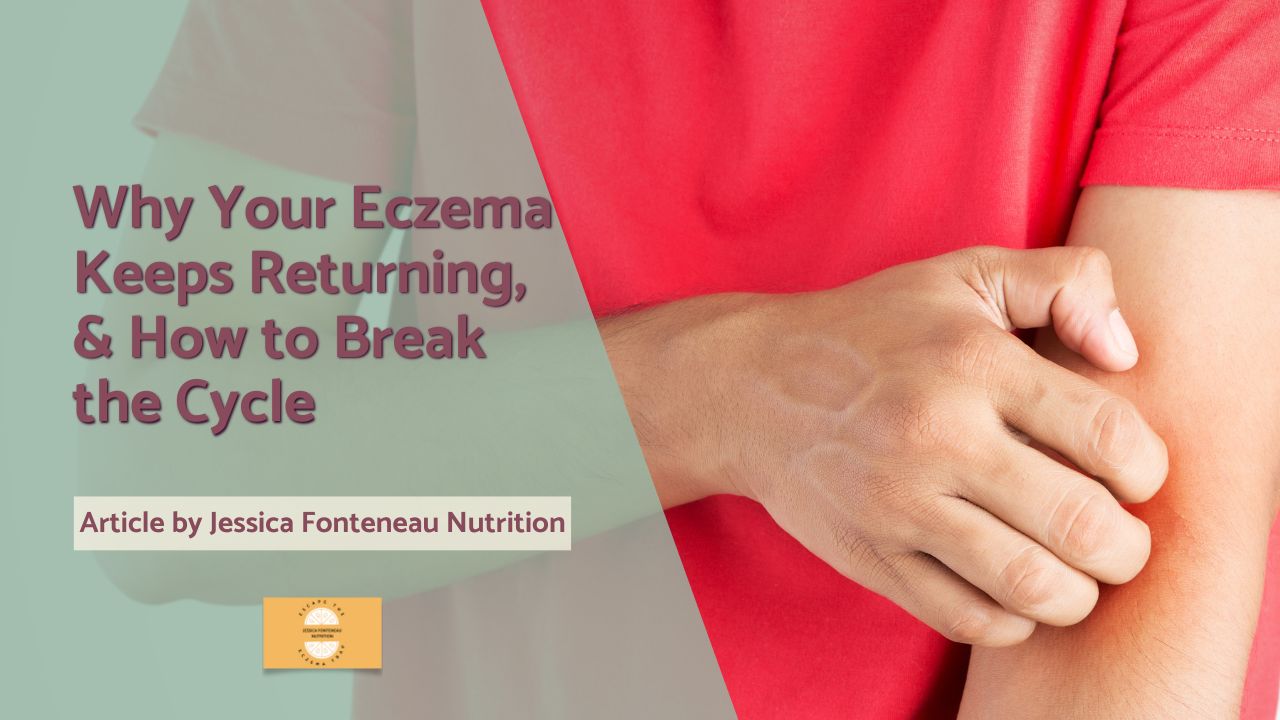 Why Your Eczema Keeps Coming Back and How to Break the Cycle