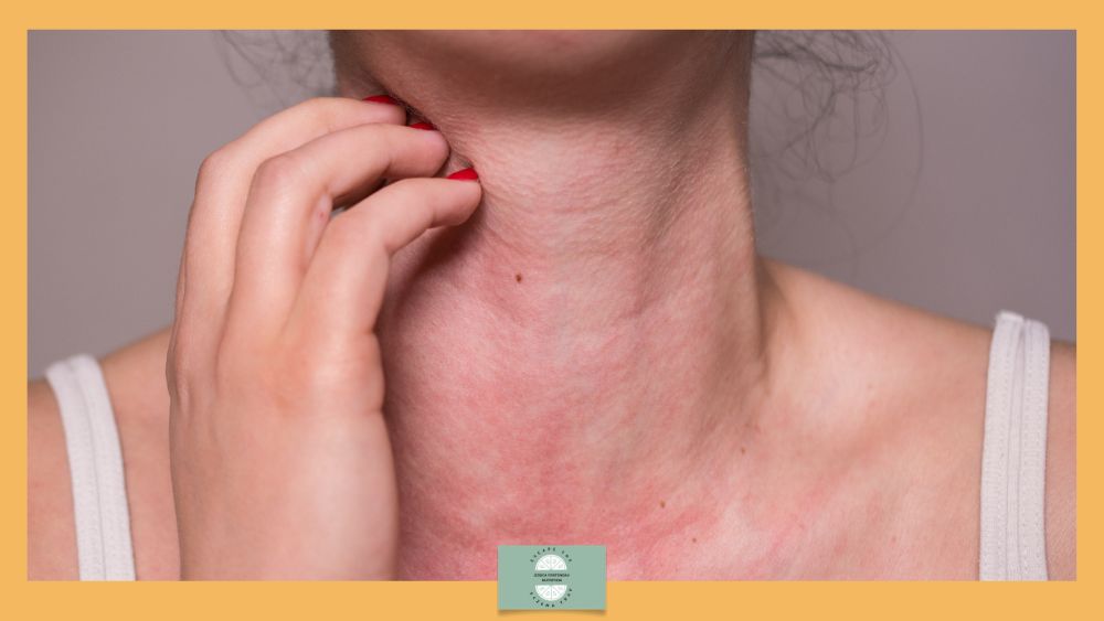 Negative Allergy Test But Strong Reactions? This is a thing - woman scratching at irritated skin on neck.