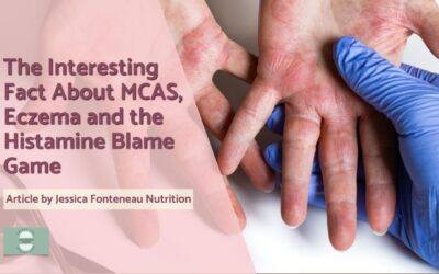 The Interesting Fact About MCAS, Eczema and the Histamine Blame Game