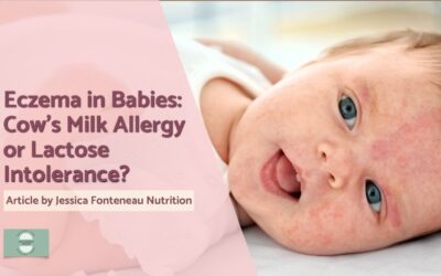 Eczema in Babies: Cow’s Milk Allergy or Lactose Intolerance?