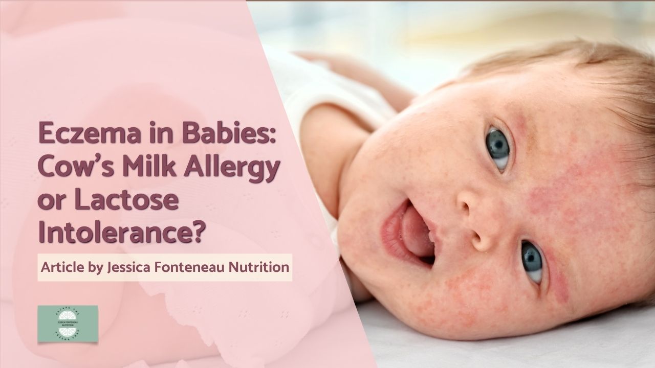 Header image for an article about eczema in babies, exploring cow's milk allergy or lactose intolerance.