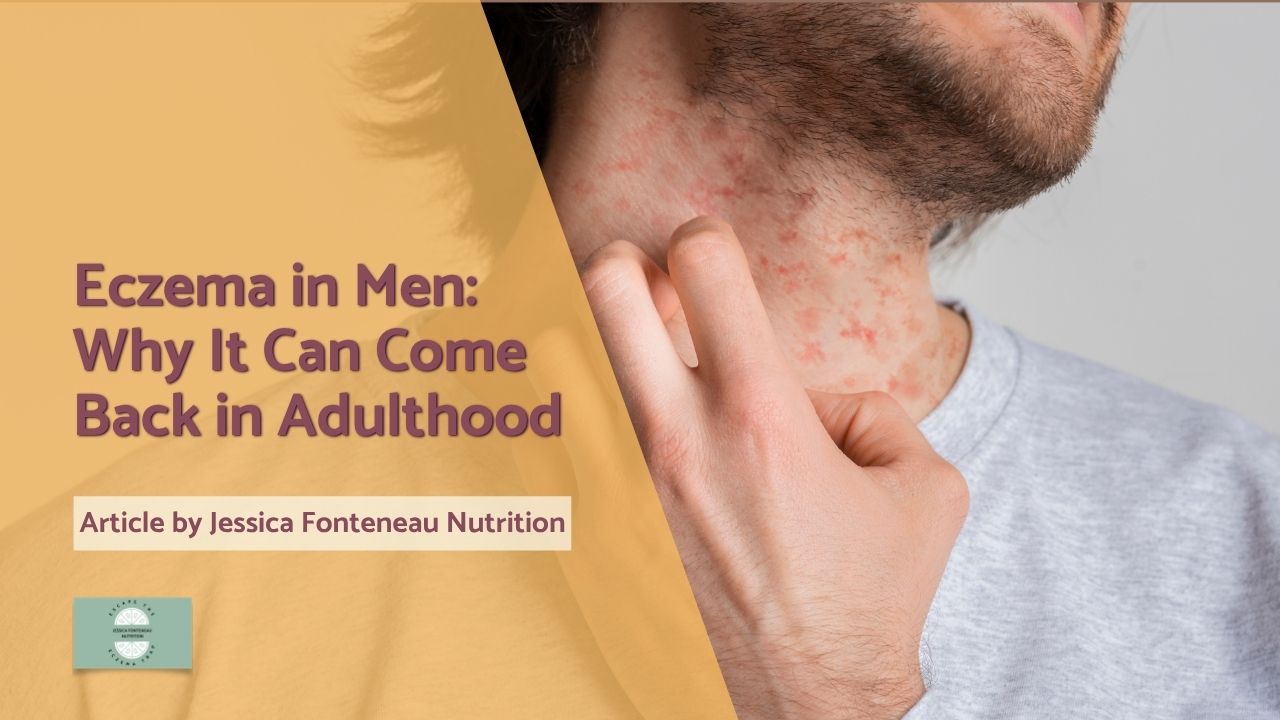 Eczema in Men: Why It Can Come Back in Adulthood - man with itchy neck
